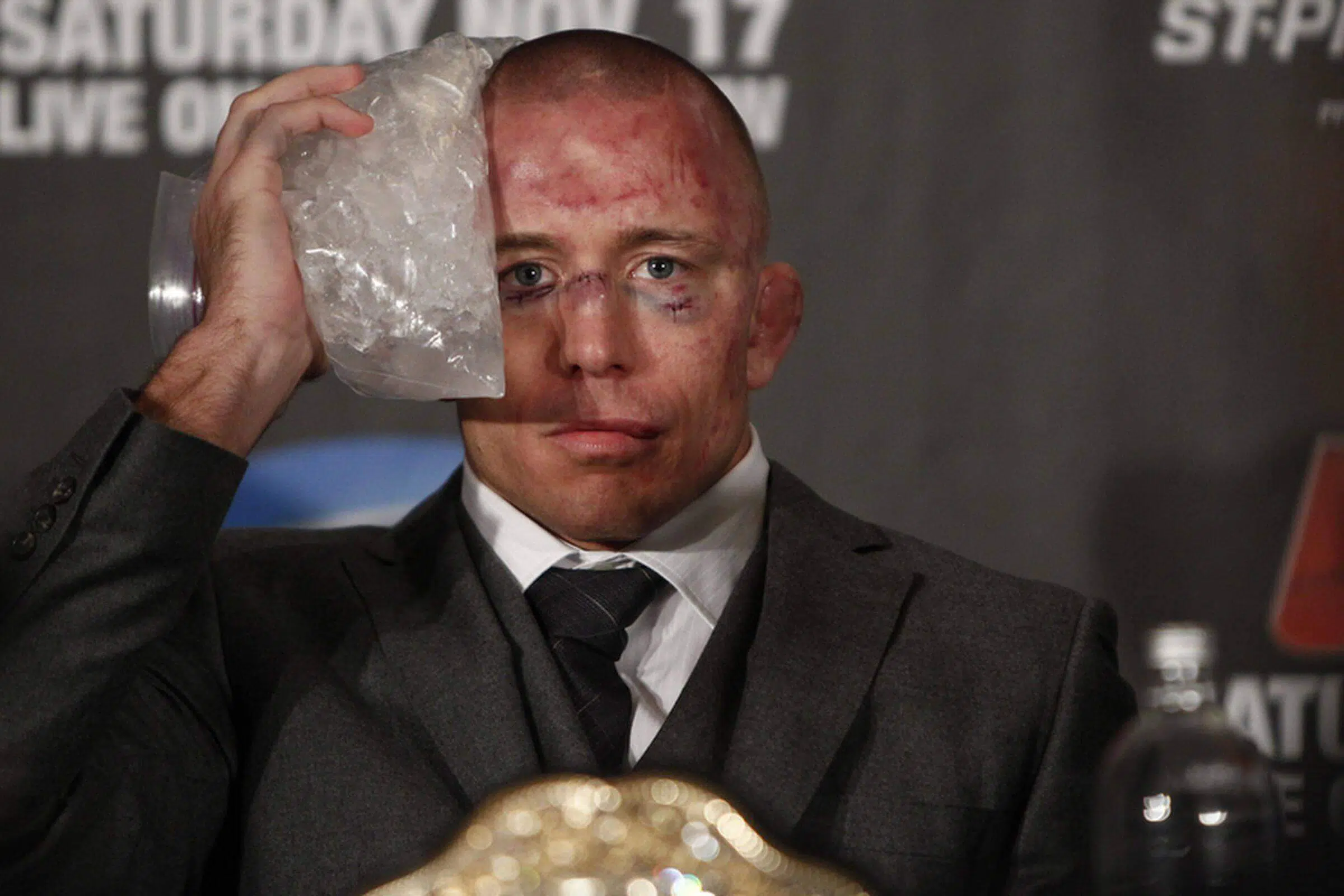 st. pierre ices face after ufc match